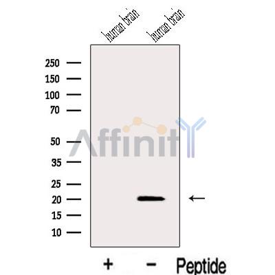 IFT27 Antibody - Western blot analysis of extracts from Human brain tissue, using IFT27 Antibody.