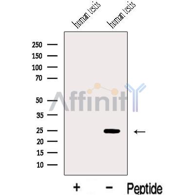 IFT43 Antibody - Western blot analysis of extracts from Human testis tissue, using IFT43 Antibody.