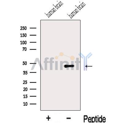 IIP45 Antibody - Western blot analysis of extracts from Human brain tissue, using IIP45 Antibody.