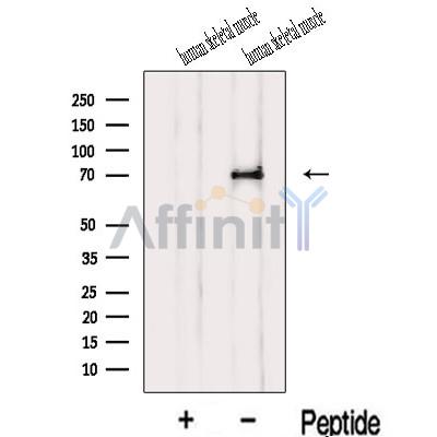 IL1RAPL1 Antibody - Western blot analysis of extracts from Human skeletal muscle  tissue, using IL1RAPL1 Antibody.