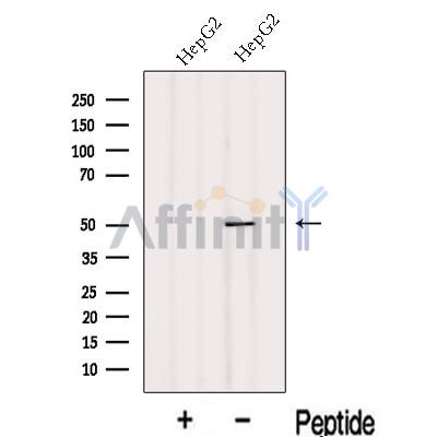 INTS12 Antibody - Western blot analysis of extracts from HepG2 cells, using INTS12 Antibody.