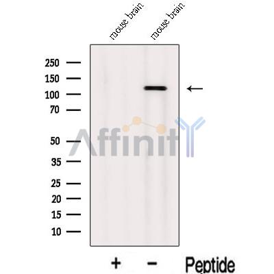 INTS3 Antibody - Western blot analysis of extracts from Mouse brain tissue, using INTS3 Antibody.