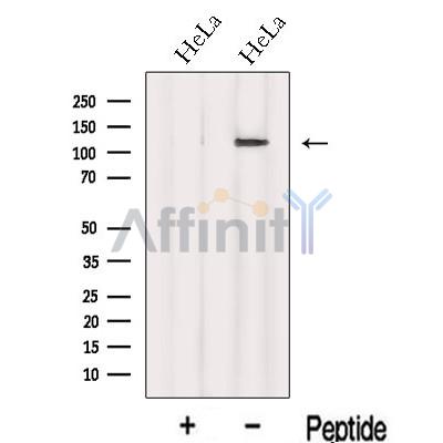 INTS8 Antibody - Western blot analysis of extracts from HeLa cells, using INTS8 Antibody.
