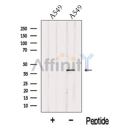 ITM2A Antibody - Western blot analysis of extracts from A549 cells, using ITM2A Antibody.