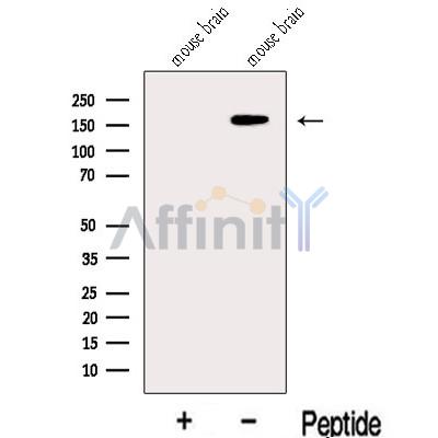 JMJD3 Antibody - Western blot analysis of extracts from Mouse brain tissue , using JMJD3 Antibody.