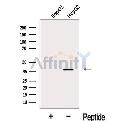 KCNAB2 Antibody - Western blot analysis of extracts from HepG2 cells, using KCNAB2 Antibody.
