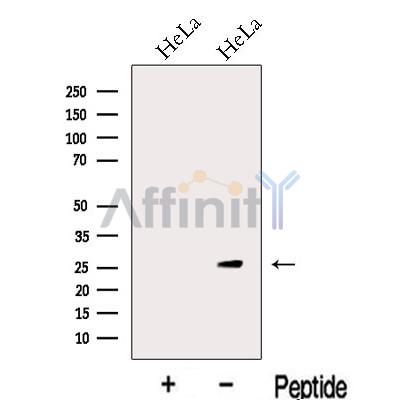 KCTD5 Antibody - Western blot analysis of extracts from HeLa cells, using KCTD5 Antibody.