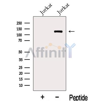 KDM2A Antibody - Western blot analysis of extracts from Jurkat cells, using KDM2A Antibody.