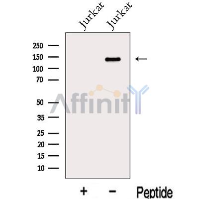 KIAA0182 Antibody - Western blot analysis of extracts from Jurkat cells, using KIAA0182 Antibody.