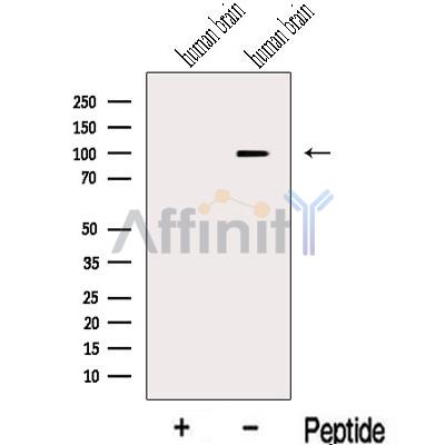 KIF19 Antibody - Western blot analysis of extracts from Human brain tissue, using KIF19 Antibody.
