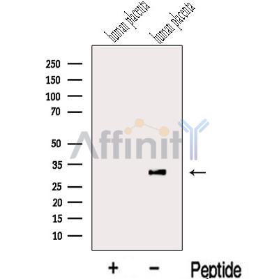 LETM2 Antibody - Western blot analysis of extracts from Human placenta tissue, using LETM2 Antibody.