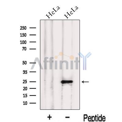 LIN7C Antibody - Western blot analysis of extracts from HeLa cells, using LIN7C Antibody.