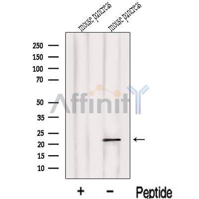 LOH12CR1 Antibody - Western blot analysis of extracts from Mouse pancreas tissue, using LOH12CR1 Antibody.