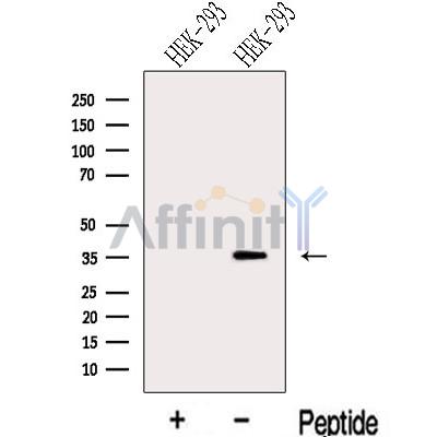 LZTFL1 Antibody - Western blot analysis of extracts from HEK-293 cells , using LZTFL1 Antibody.