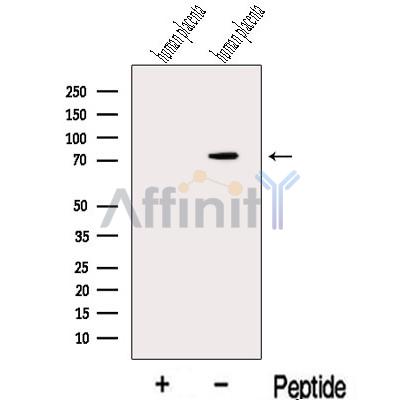 MAN1A2 Antibody - Western blot analysis of extracts from Human placenta tissue, using MAN1A2 Antibody.