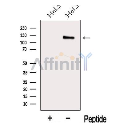 MAP1S Antibody - Western blot analysis of extracts from HeLa cells, using MAP1S Antibody.