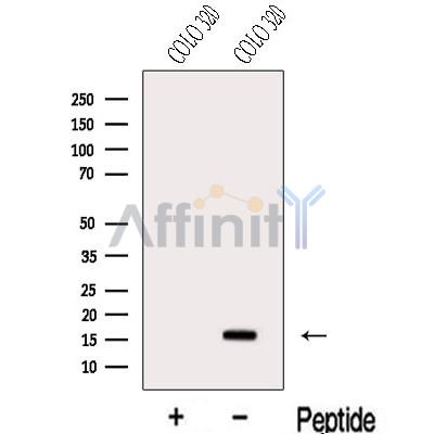 MED10 Antibody - Western blot analysis of extracts from COLO 320 cells, using MED10 Antibody.