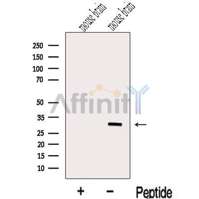 METTL1 Antibody - Western blot analysis of extracts from Mouse brain tissue, using METTL1 Antibody.