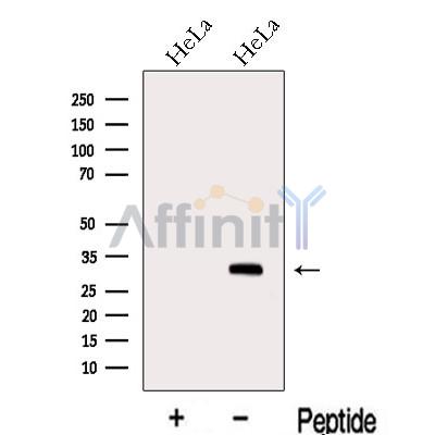 METTL6 Antibody - Western blot analysis of extracts from HeLa cells, using METTL6 Antibody.