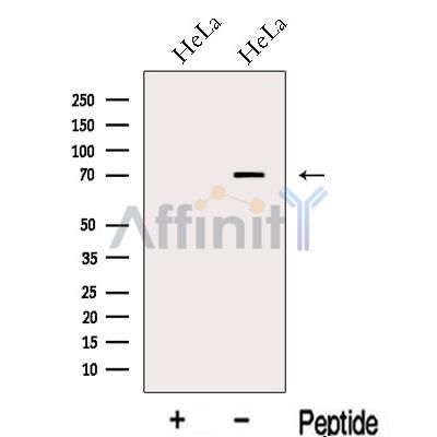 MEX3C Antibody - Western blot analysis of extracts from HeLa cells, using MEX3C Antibody.