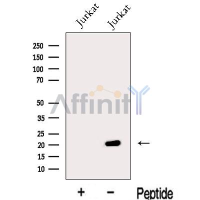 MFAP5 Antibody - Western blot analysis of extracts from Jurkat cells, using MFAP5 Antibody.