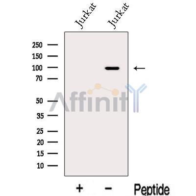 MGAT5B Antibody - Western blot analysis of extracts from Jurkat cells, using MGAT5B Antibody.