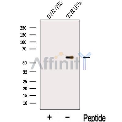 MIER3 Antibody - Western blot analysis of extracts from Mouse uterus  tissue, using MIER3 Antibody.