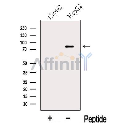 MIPEP Antibody - Western blot analysis of extracts from HepG2 cells, using MIPEP Antibody.