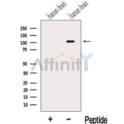 MLK2 Antibody - Western blot analysis of extracts from Human brain tissue, using MLK2 Antibody.