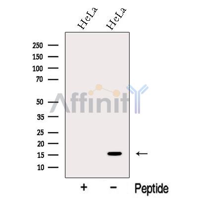 MMS2 Antibody - Western blot analysis of extracts from HeLa cells, using MMS2 Antibody.