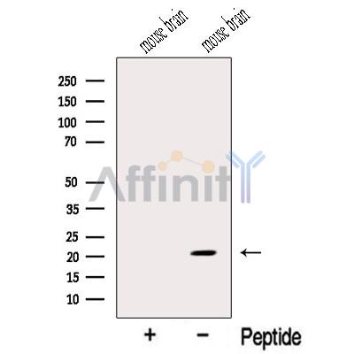 MOBP Antibody - Western blot analysis of extracts from Mouse brain tissue, using MOBP Antibody.