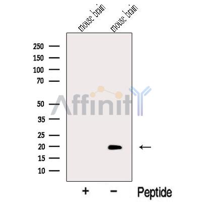 MTP18 Antibody - Western blot analysis of extracts from Mouse brain tissue, using MTP18 Antibody.