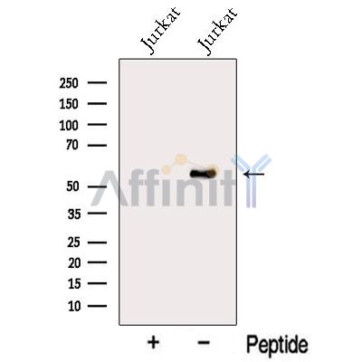 MYEOV Antibody - Western blot analysis of extracts from Jurkat cells, using MYEOV Antibody.