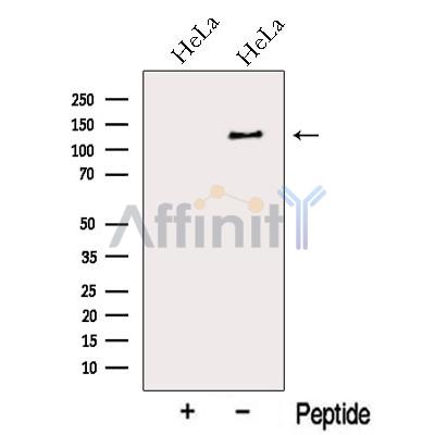 MYO1E Antibody - Western blot analysis of extracts from HeLa cells, using MYO1E Antibody.