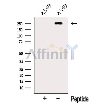 Myoferlin Antibody - Western blot analysis of extracts from A549 cells, using Myoferlin Antibody.
