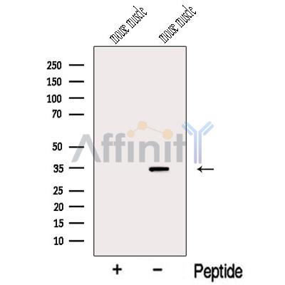 MYOZ1 Antibody - Western blot analysis of extracts from Mouse muscle tissue, using MYOZ1 Antibody.