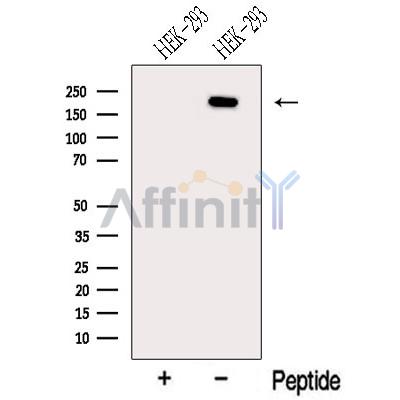 NCOA6 Antibody - Western blot analysis of extracts from HEK-293 cells, using NCOA6 Antibody.
