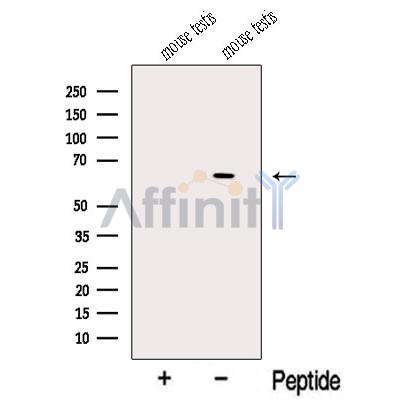 NDOR1 Antibody - Western blot analysis of extracts from Mouse testis tissue, using NDOR1 Antibody.