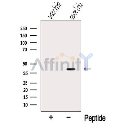 NECAP1 Antibody - Western blot analysis of extracts from Mouse brain tissue, using NECAP1 Antibody.