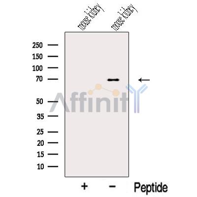 NPLOC4 Antibody - Western blot analysis of extracts from Mouse kidney tissue, using NPLOC4 Antibody.