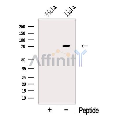 NR1D2 Antibody - Western blot analysis of extracts from HeLa cells, using NR1D2 Antibody.