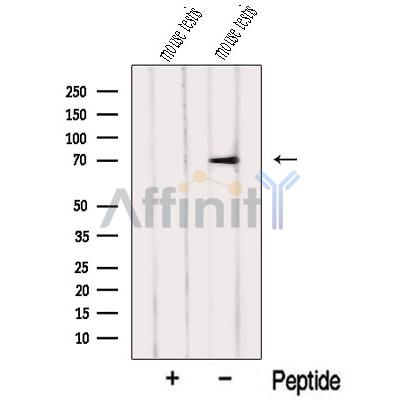 NXF2 Antibody - Western blot analysis of extracts from Mouse testis tissue, using NXF2 Antibody.