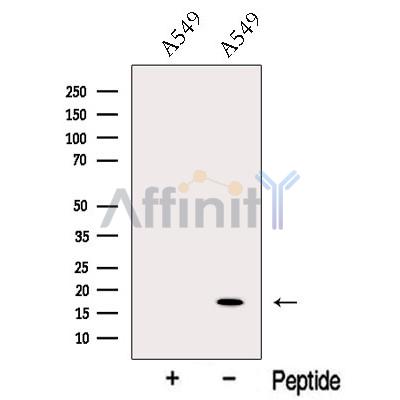 ODAM Antibody - Western blot analysis of extracts from A549 cells, using ODAM Antibody.