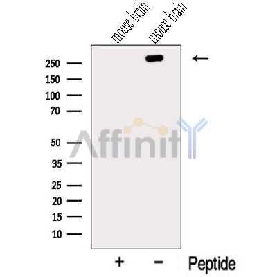 ODZ1 Antibody - Western blot analysis of extracts from Mouse brain tissue, using ODZ1 Antibody.