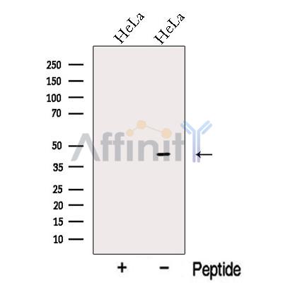 OFD1 Antibody - Western blot analysis of extracts from HeLa cells, using OFD1 Antibody.