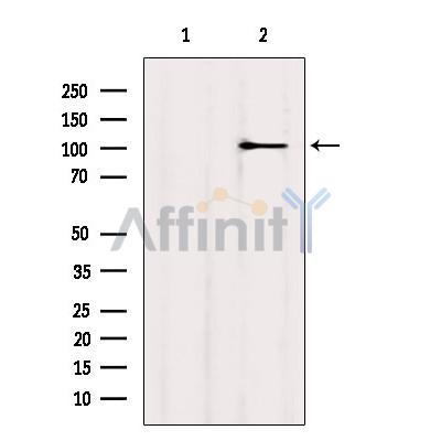 MYOCD Antibody - Western blot analysis of extracts from MCF7, using MYOCD Antibody.