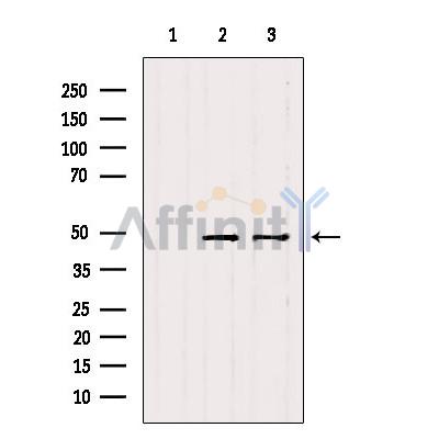 KRT31/33A/33B Antibody - Western blot analysis of extracts from various samples, using KRT31/33A/33B Antibody.