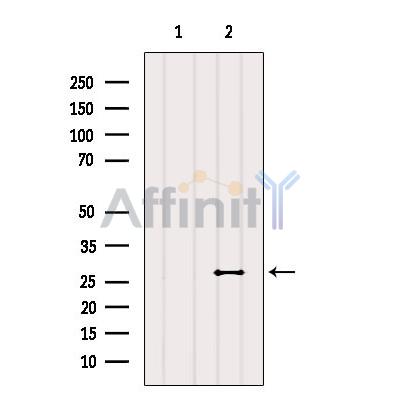 RAB20 Antibody - Western blot analysis of extracts from Hela, using RAB20 Antibody.