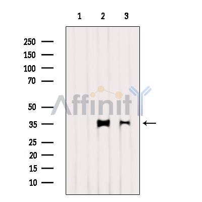 LDHA Antibody - Western blot analysis of extracts from various samples, using LDHA  Antibody.