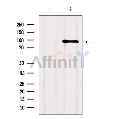 NFAT1 Antibody - Western blot analysis of extracts from Hela, using NFATC2 Antibody.